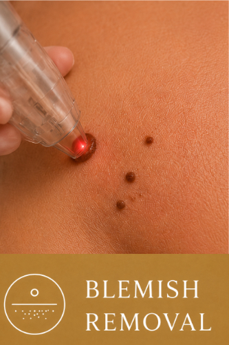 Blemish Removal