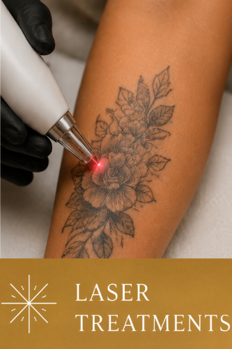 Laser Treatments