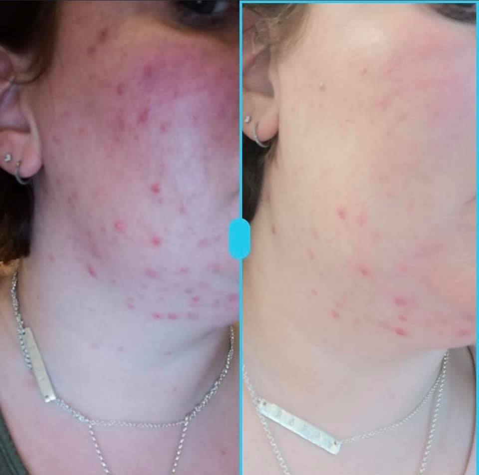 Million Dollar Medi+ Glyco Wash