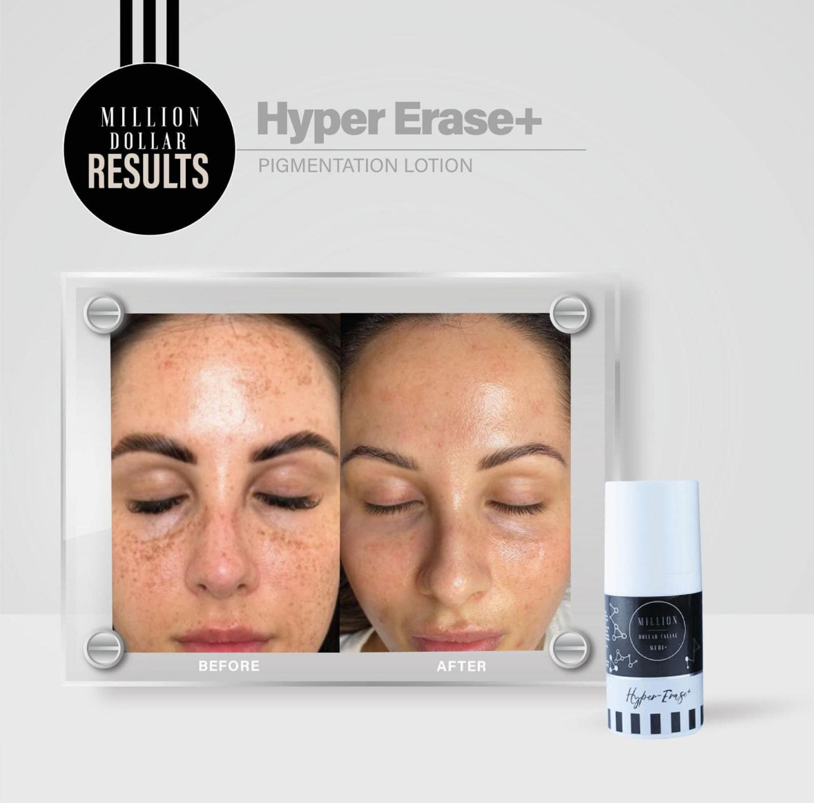 Medi+ Hyper Erase