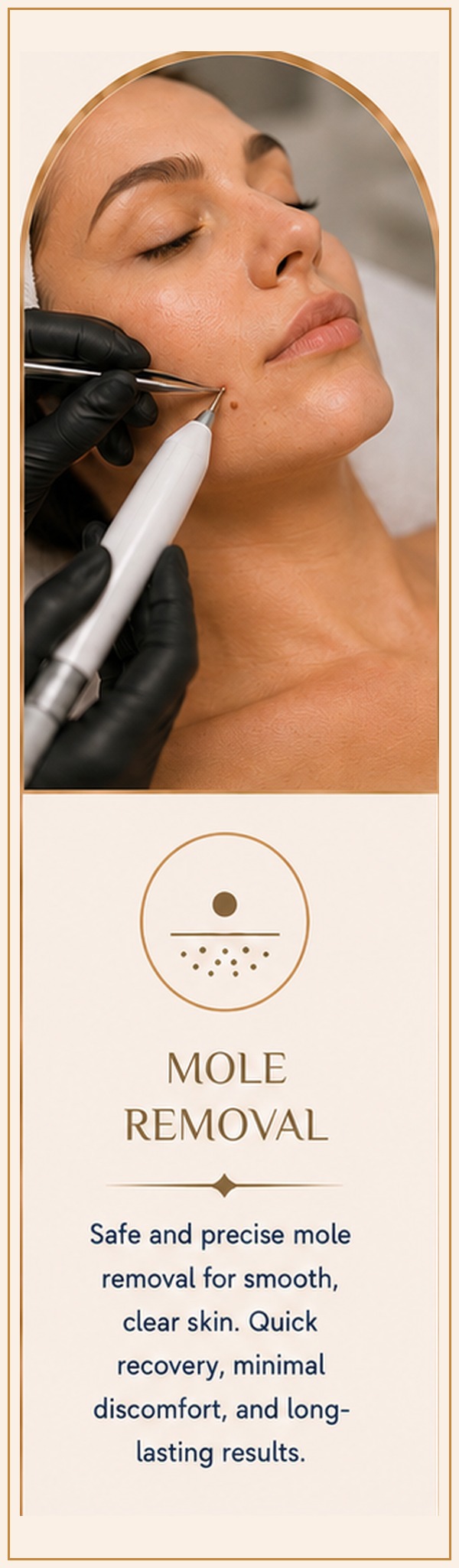 Mole Removal