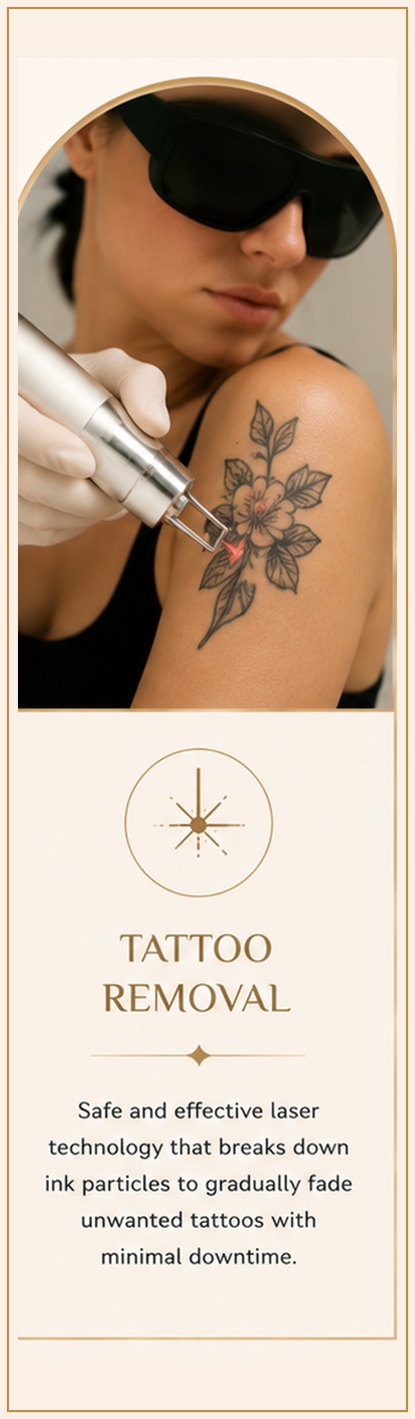 Tattoo removal